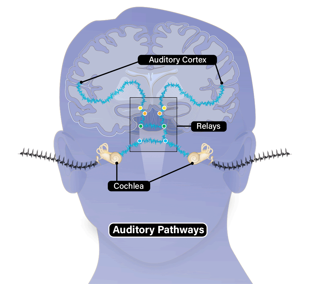 Brain – Auditory Pathways